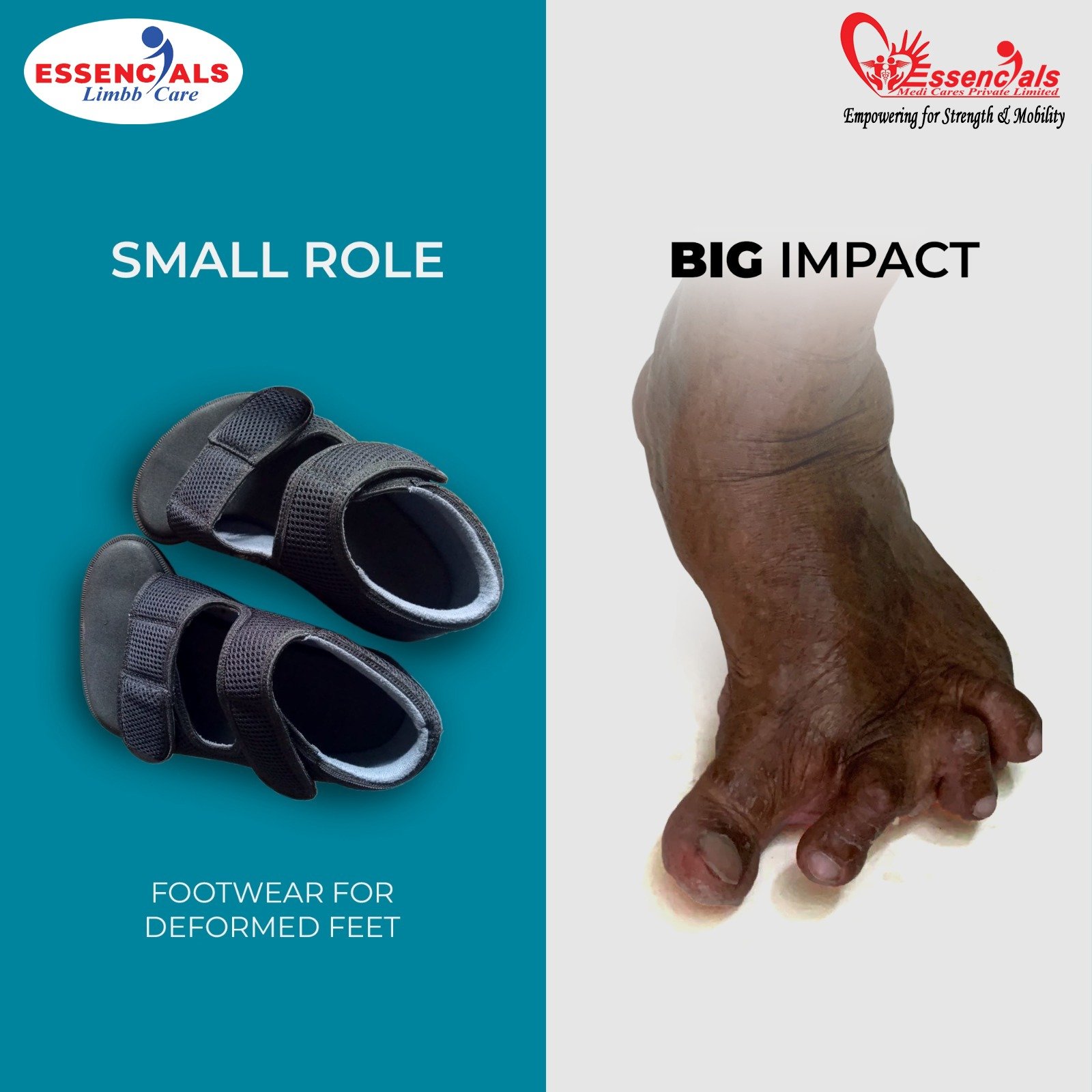 Deformed feet footwear