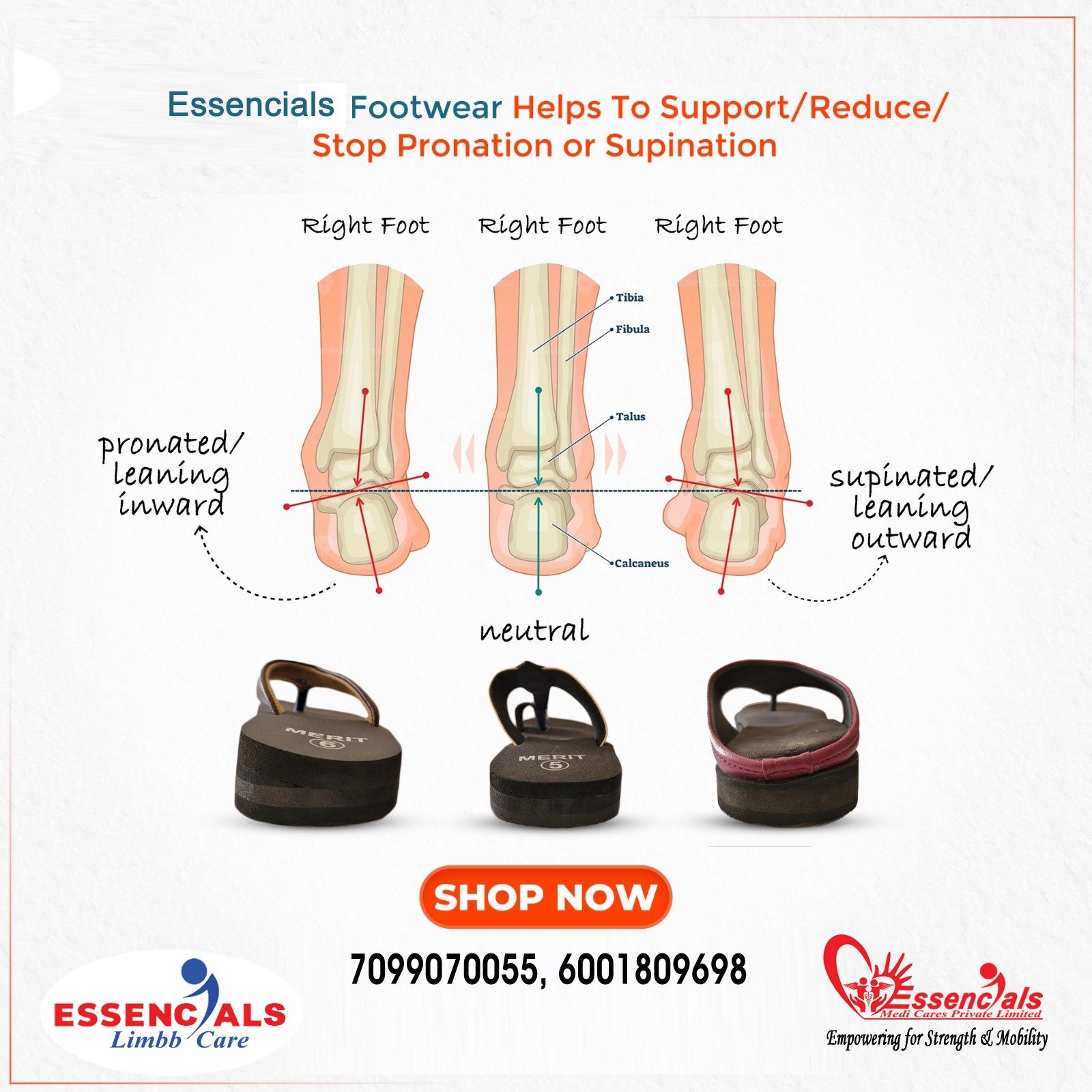 Foot  Alignment correction orthopedic footwear